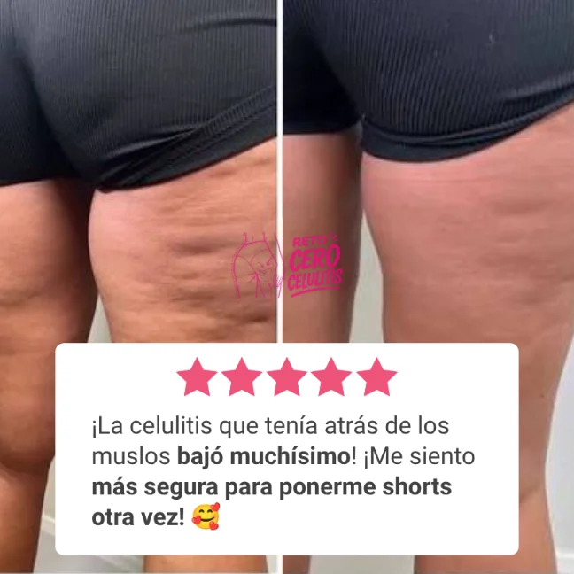 Testimonio 3